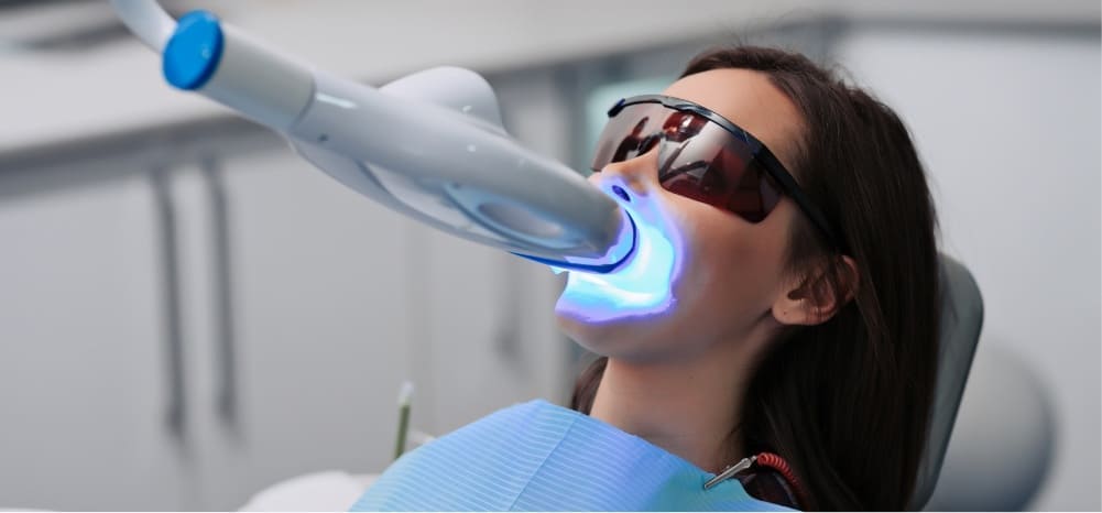 Blanqueamiento dental en Lanzarote en  la clínica dental Vega Ginory en Arrecife