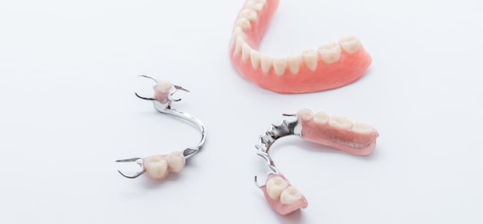 Prótesis dentales en Lanzarote en la clínica dental Vega Ginory en Arrecife