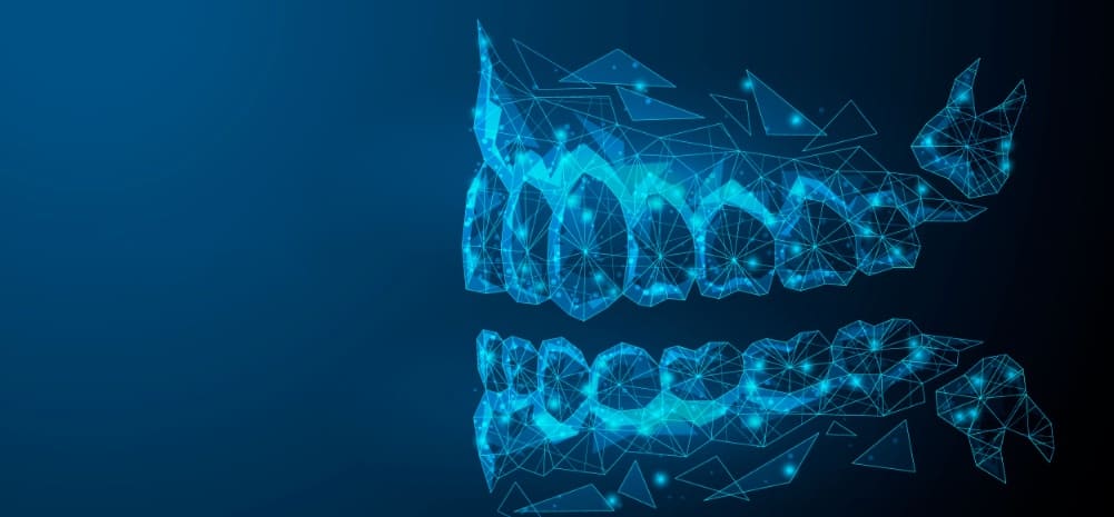 Diseño de sonrisa en Lanzarote en la clínica dental Vega Ginory en Arrecife