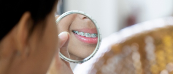Ortodoncia en Lanzarote en la clínica dental Vega Ginory en Arrecife