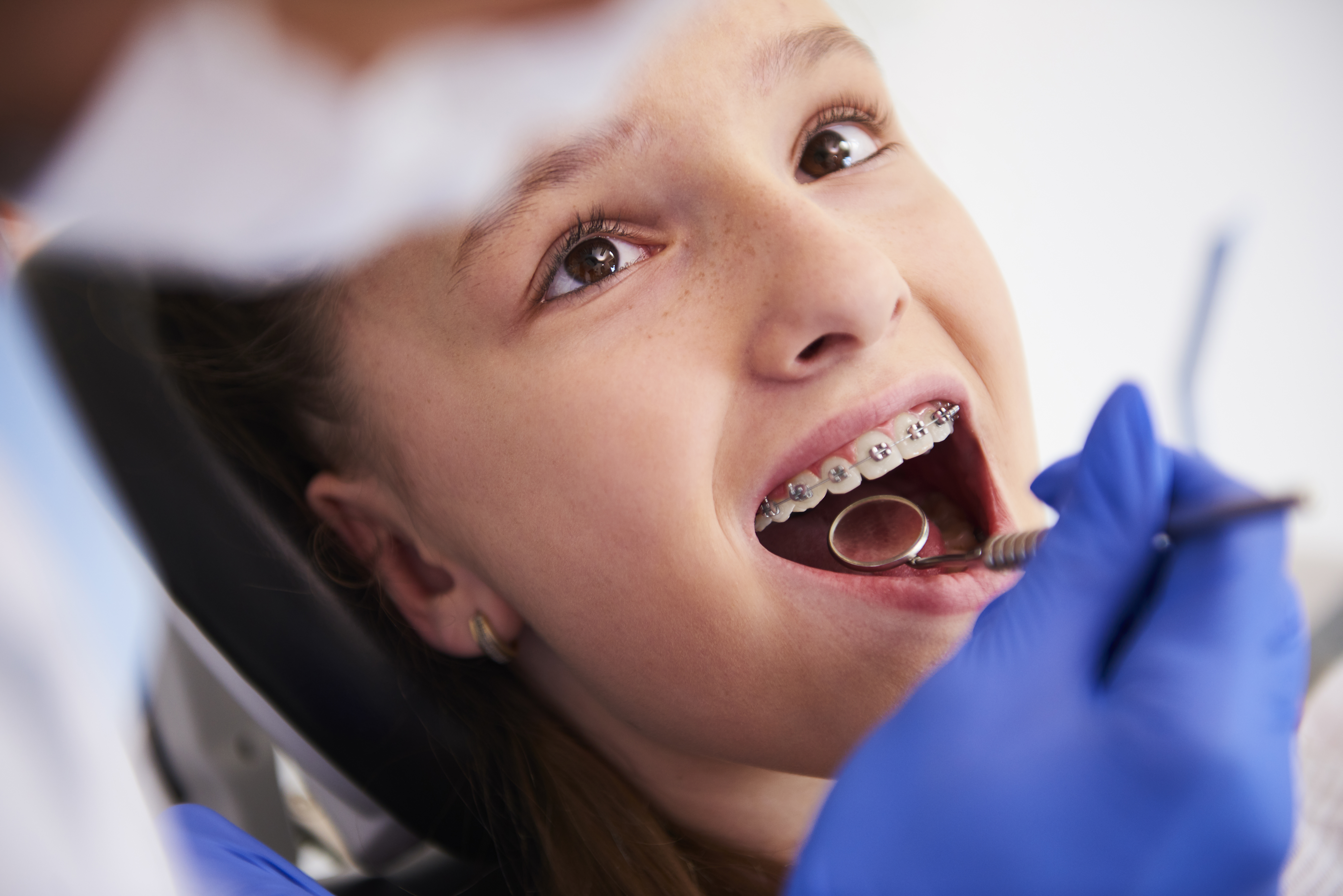ortodoncia infantil en lanzarote por la clínica dental Vega Ginory
