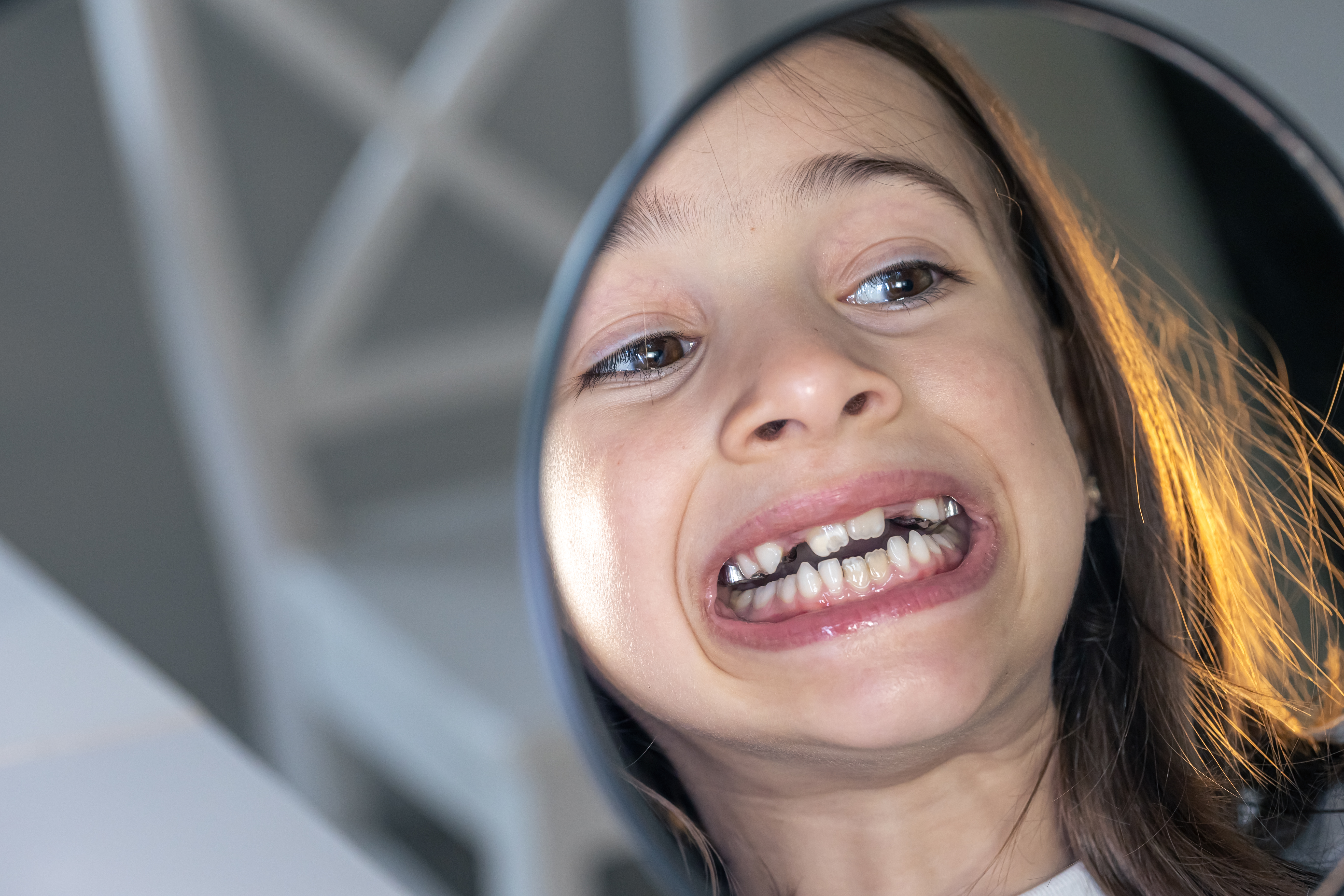Problemas que causa el paladar estrecho en la clínica dental Vega Ginory en Lanzarote
