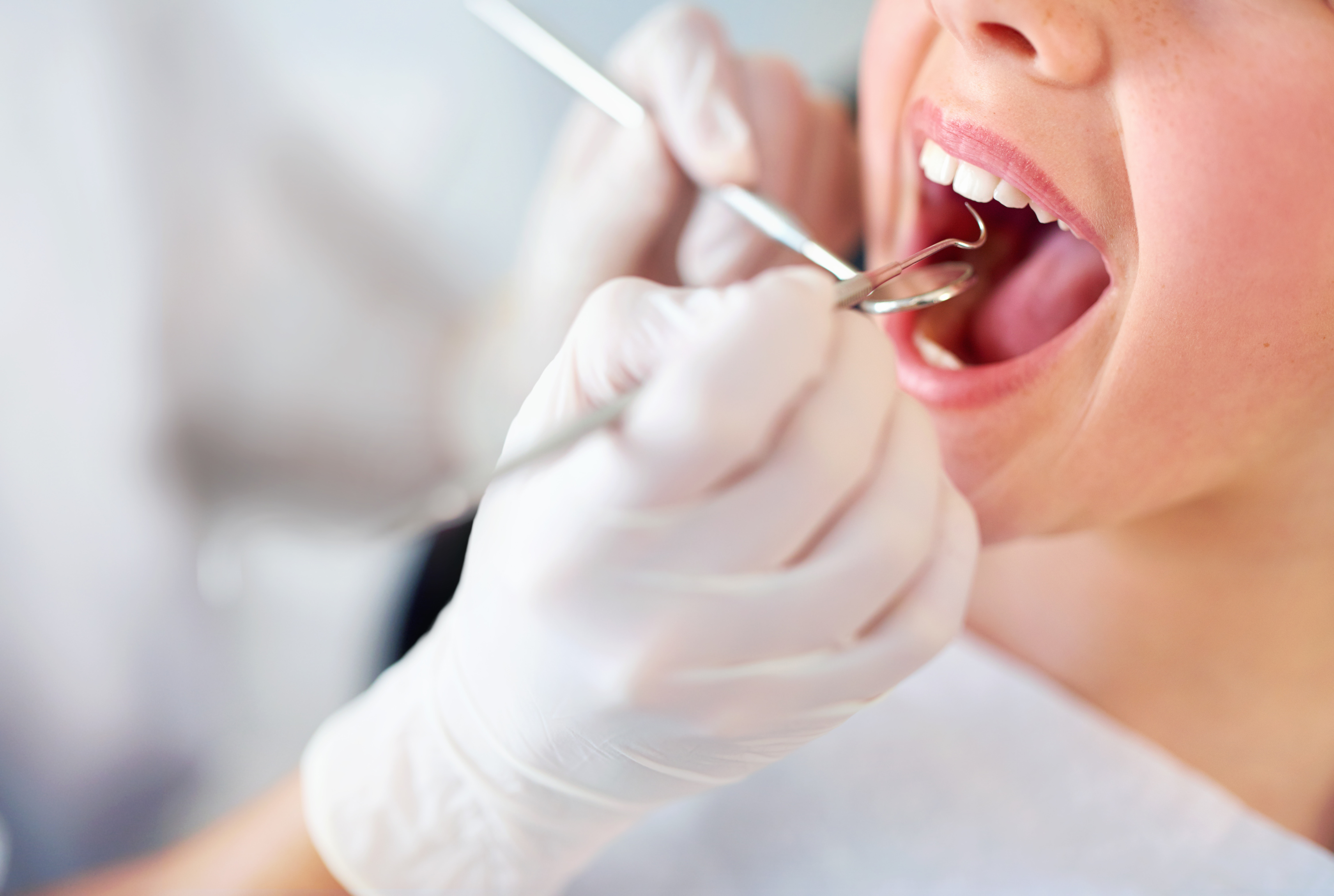 La importancia del raspado radicular en la salud de las encias por la clinica dental vega ginory en lanzarote