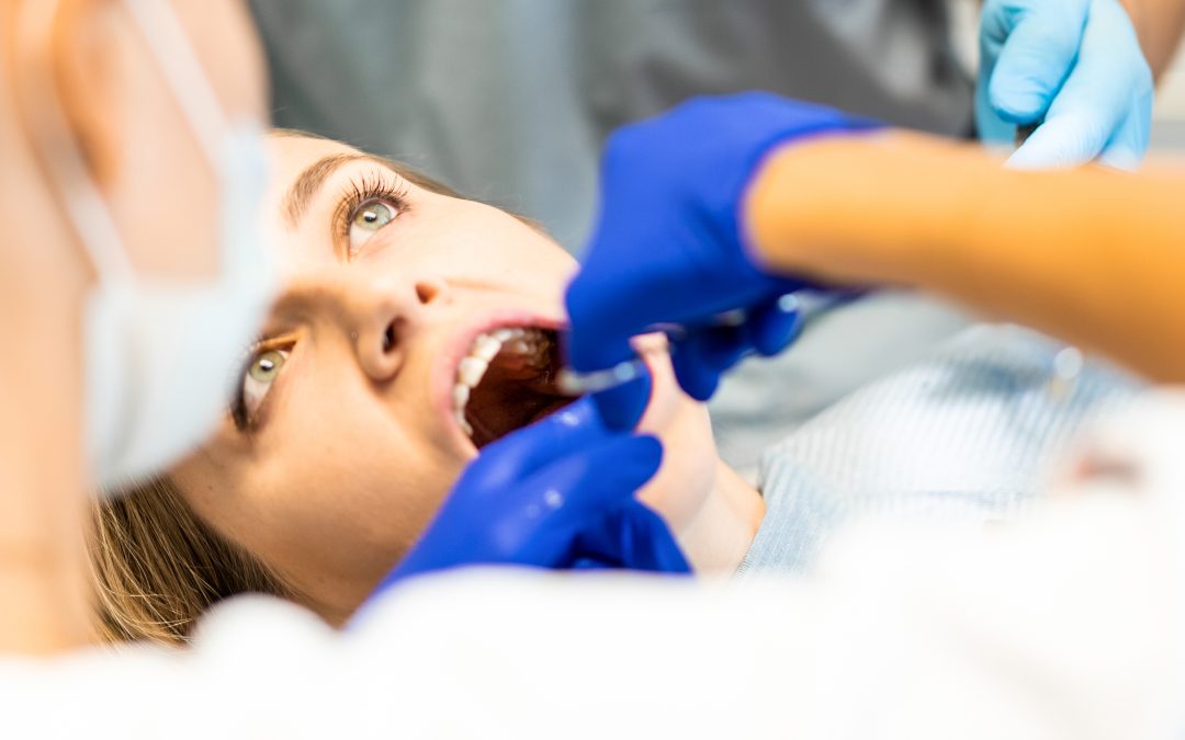 Qué comer después de una extracción dental: guía completa para una recuperación sin complicaciones