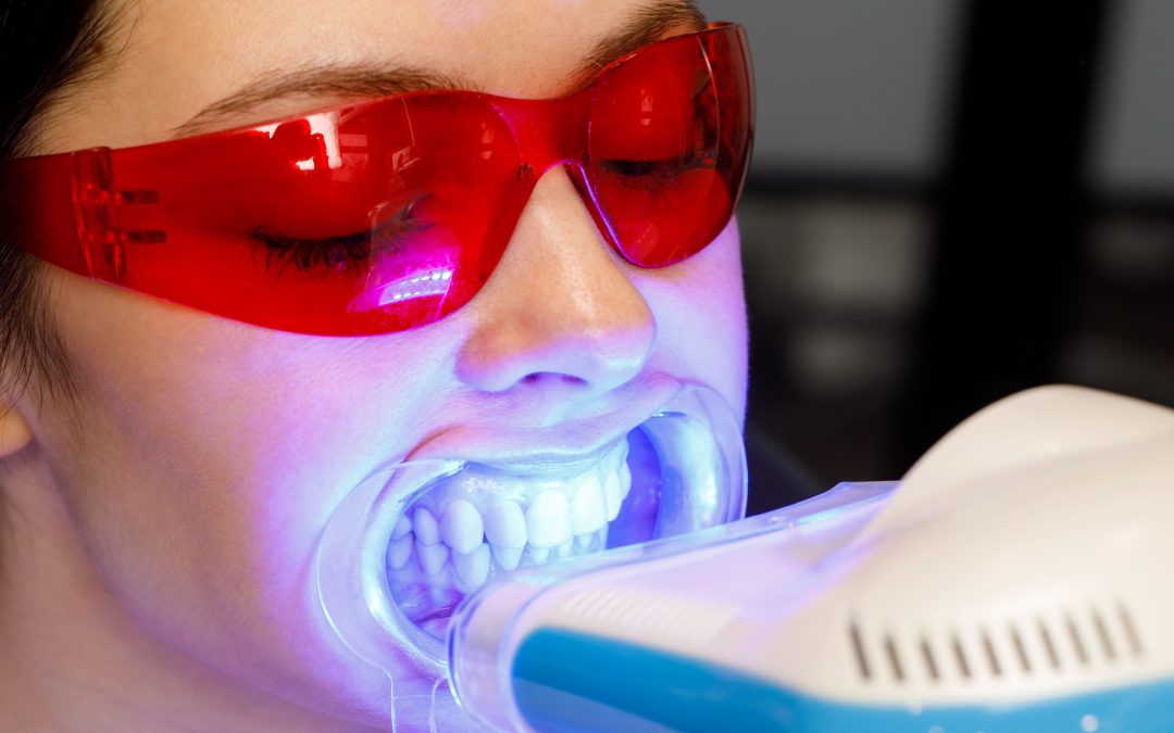 5 consejos para que te dure más tiempo un blanqueamiento dental
