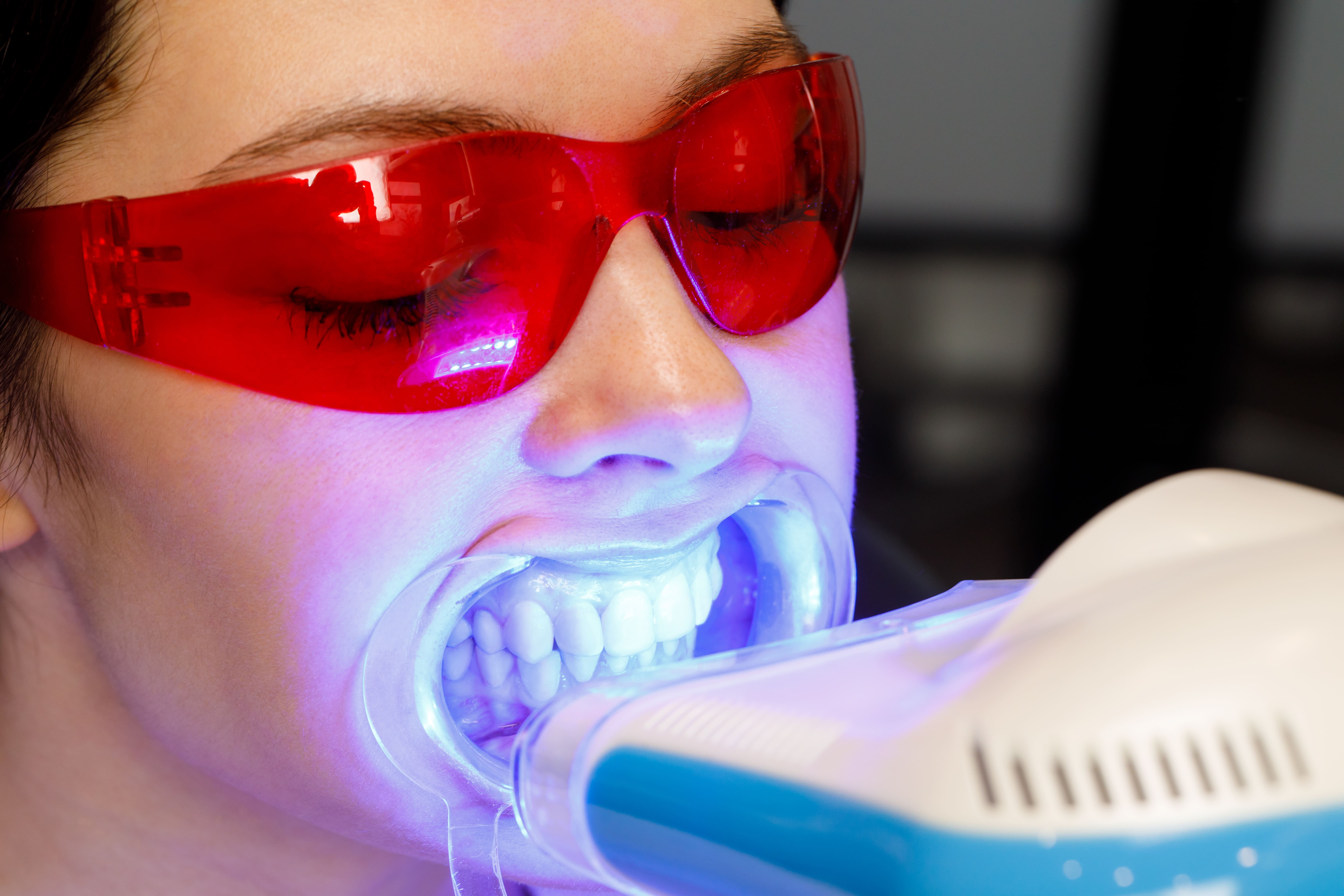 una mujer joven recibe un-procedimiento de blanqueamiento dental en una clinica dental