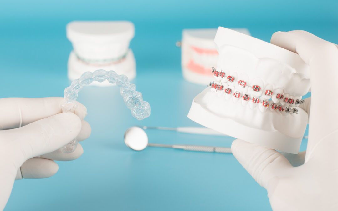 Ortodoncia invisible o brackets: qué mirar antes de decidirte